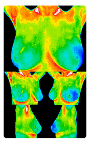 Sample of Normal Breast Study